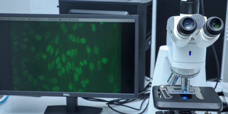 Mərkəzi Neftçilər Xəstəxanasında yeni autoimmun laboratoriyası istifadəyə verilib